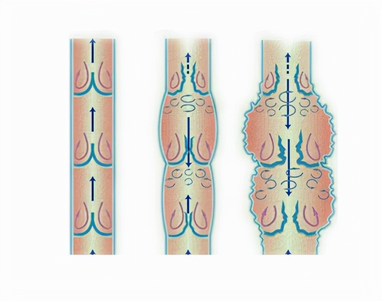 静脉瓣作用图片