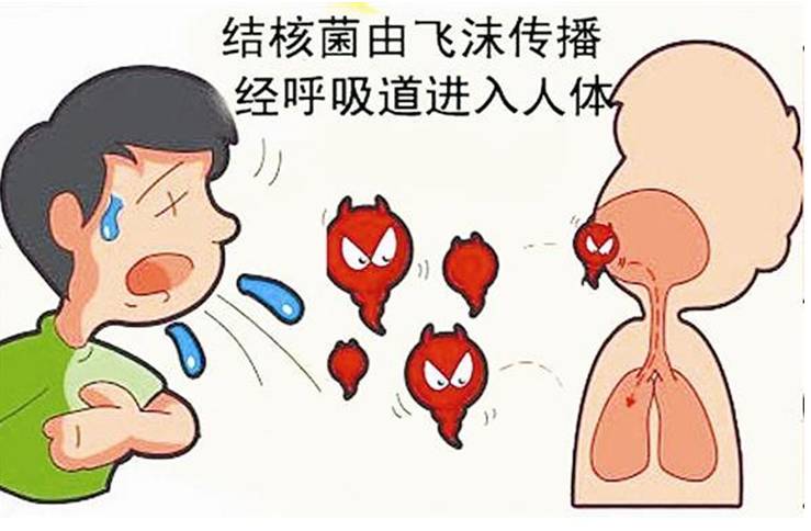 这种病有怎样的症状,哪一群体易得此病?