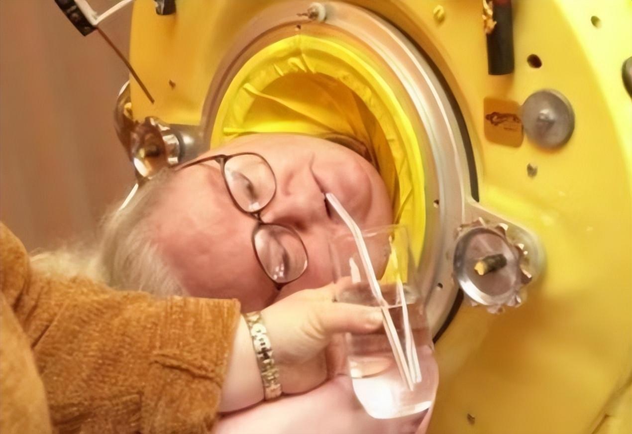 "铁肺人"保罗,一个困在铁桶里69年的男人