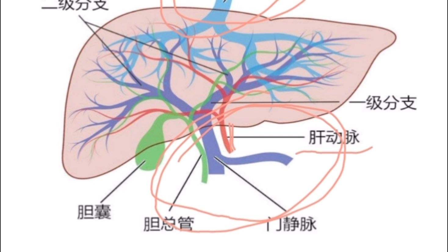 得了肝硬化了,b超有哪些提示?