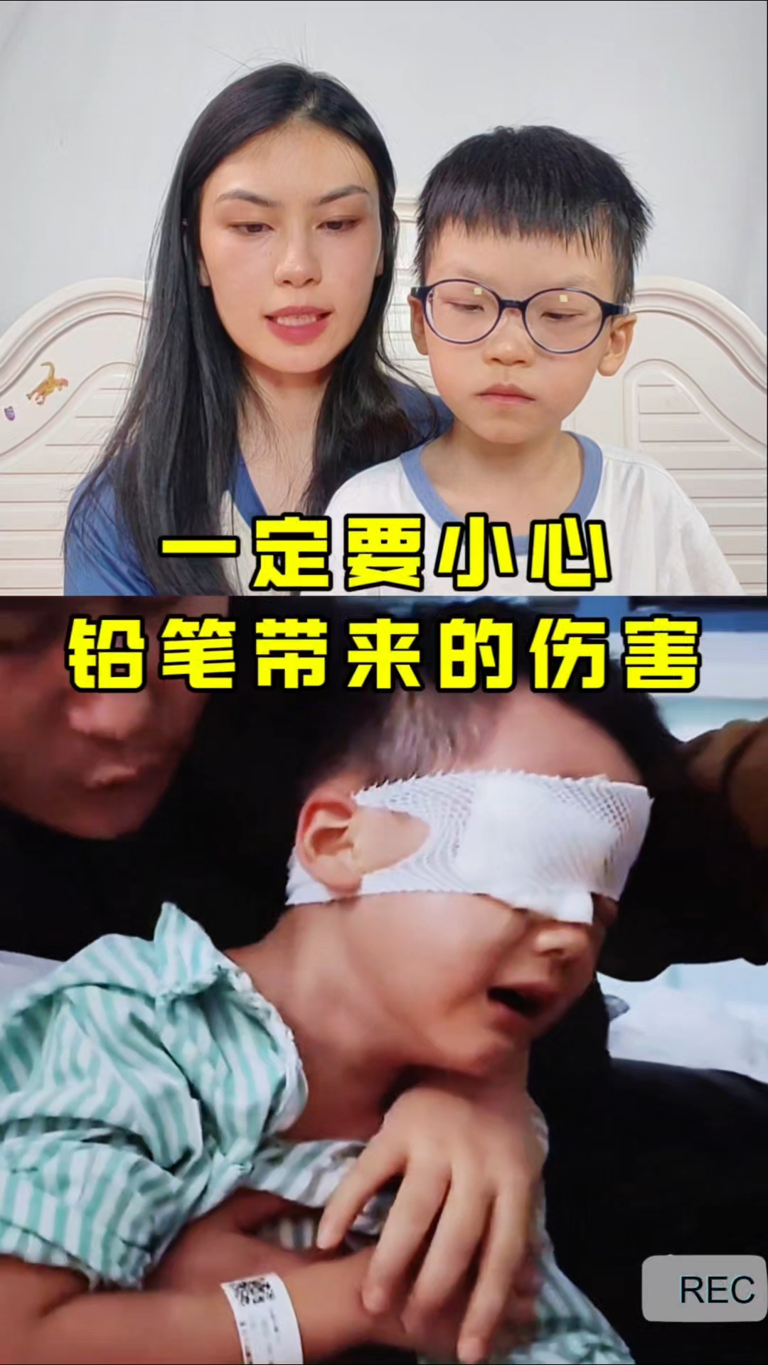 最近真实案例,幼儿园小朋友被铅笔戳破眼睛导致失明