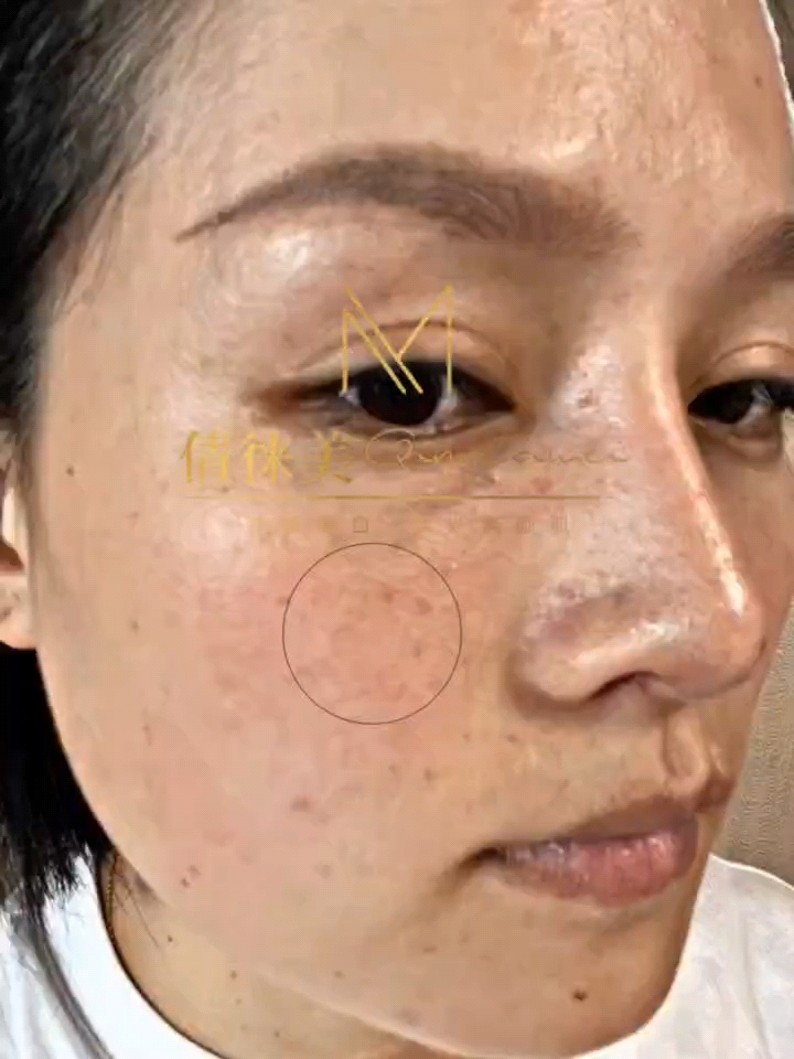 倩徕美淡斑美白,美丽加倍