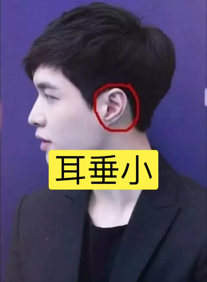 耳垂小