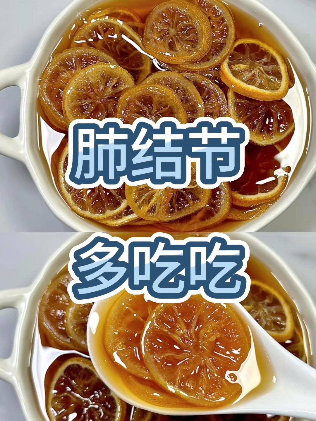 体内有结节可以吃蜂蜜吗(结节可以吃蜂蜜水吗)