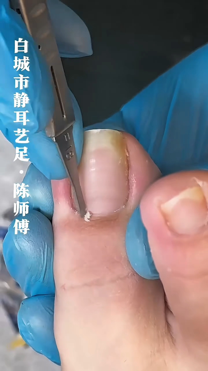 修脚怎么修视频