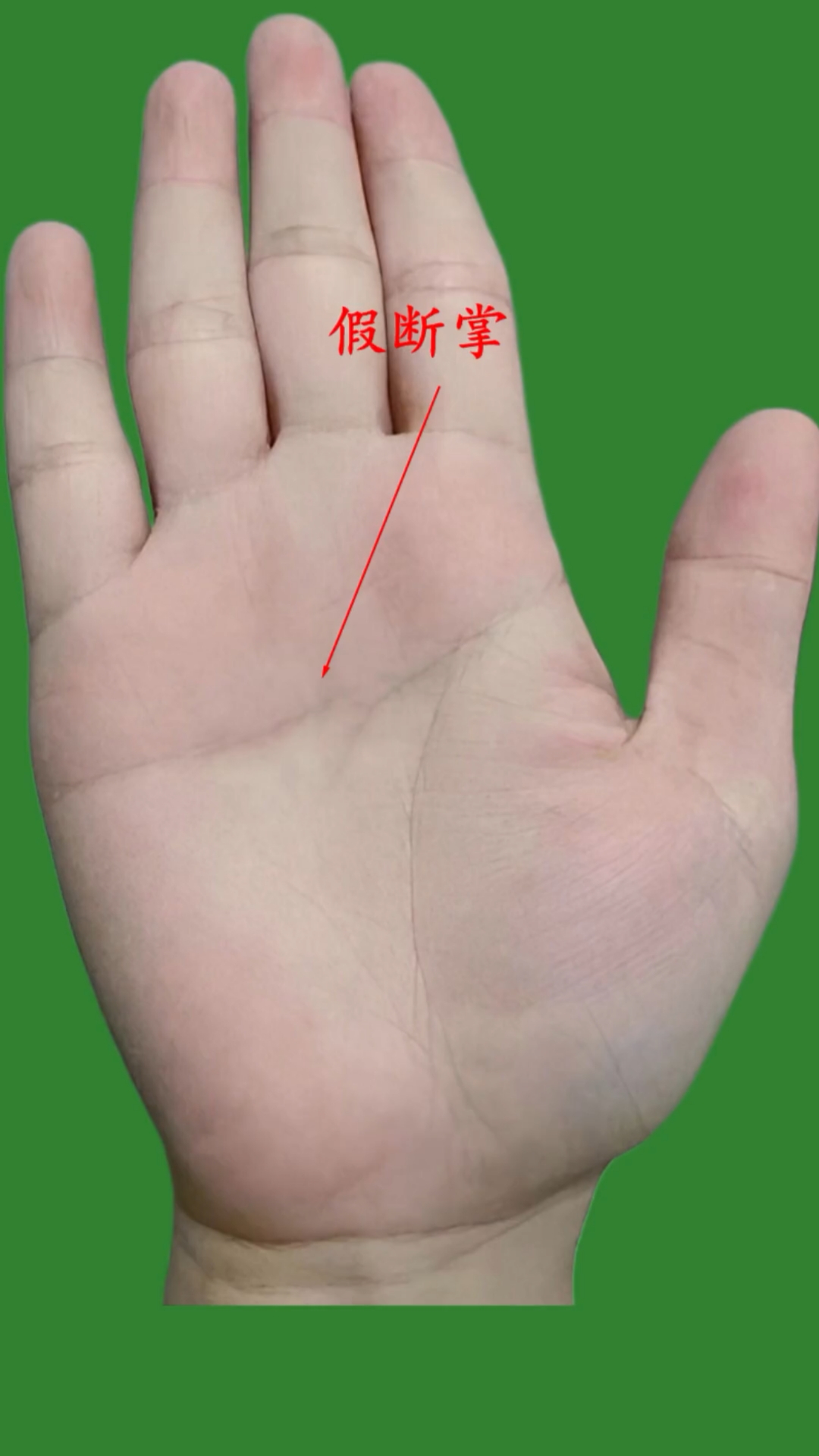 你知道什么是假断掌?