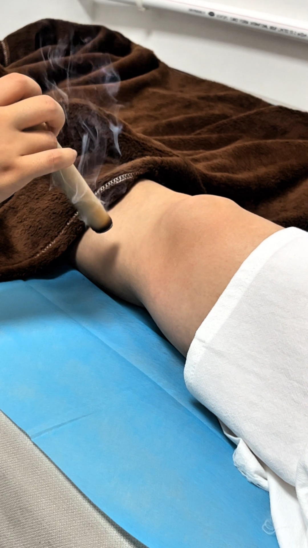 年轻轻轻怎么膝盖就开始疼了!艾条悬灸时间:15