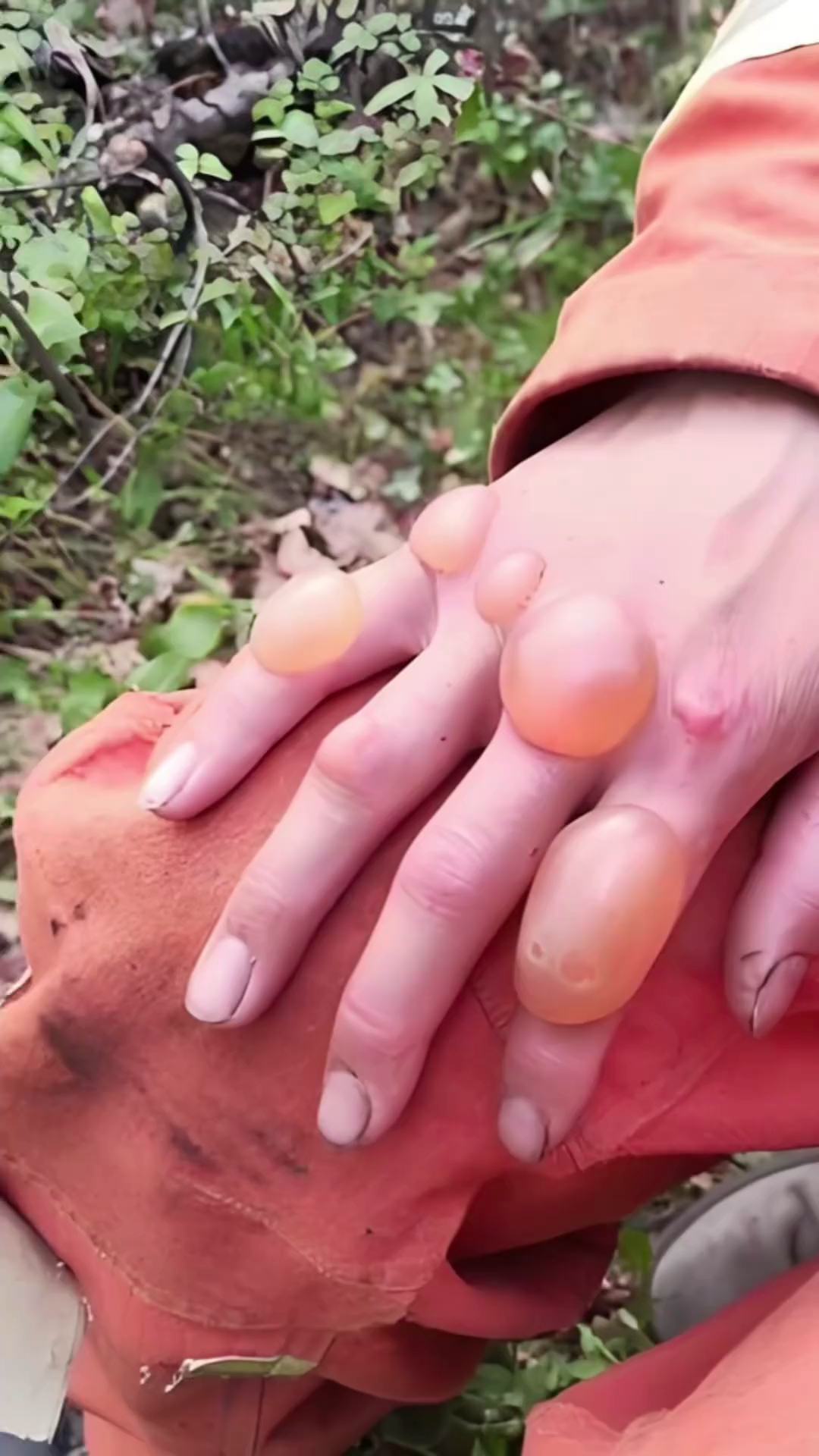 救火手被烫起泡,看着心疼又心酸,致敬无私的消防战士!