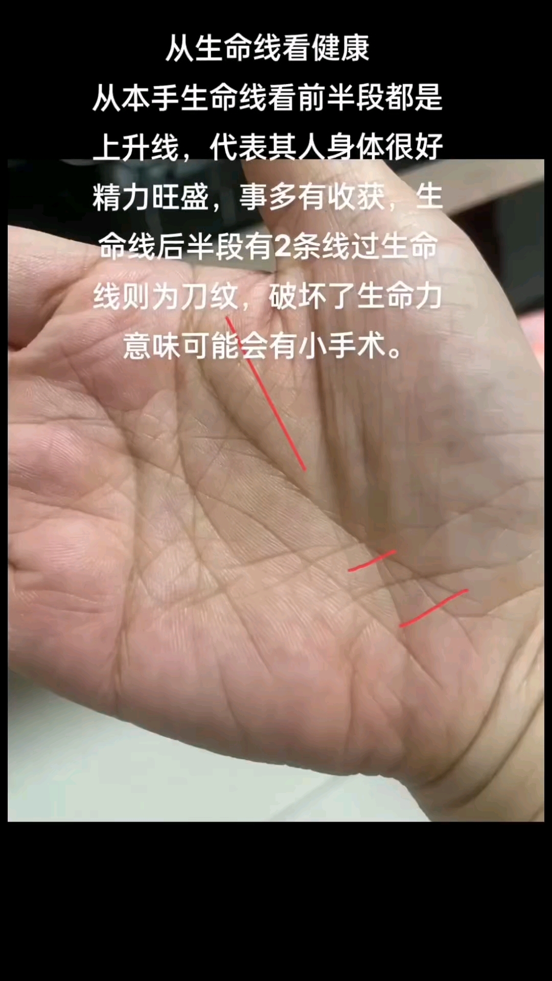 生命线代表着健康吗