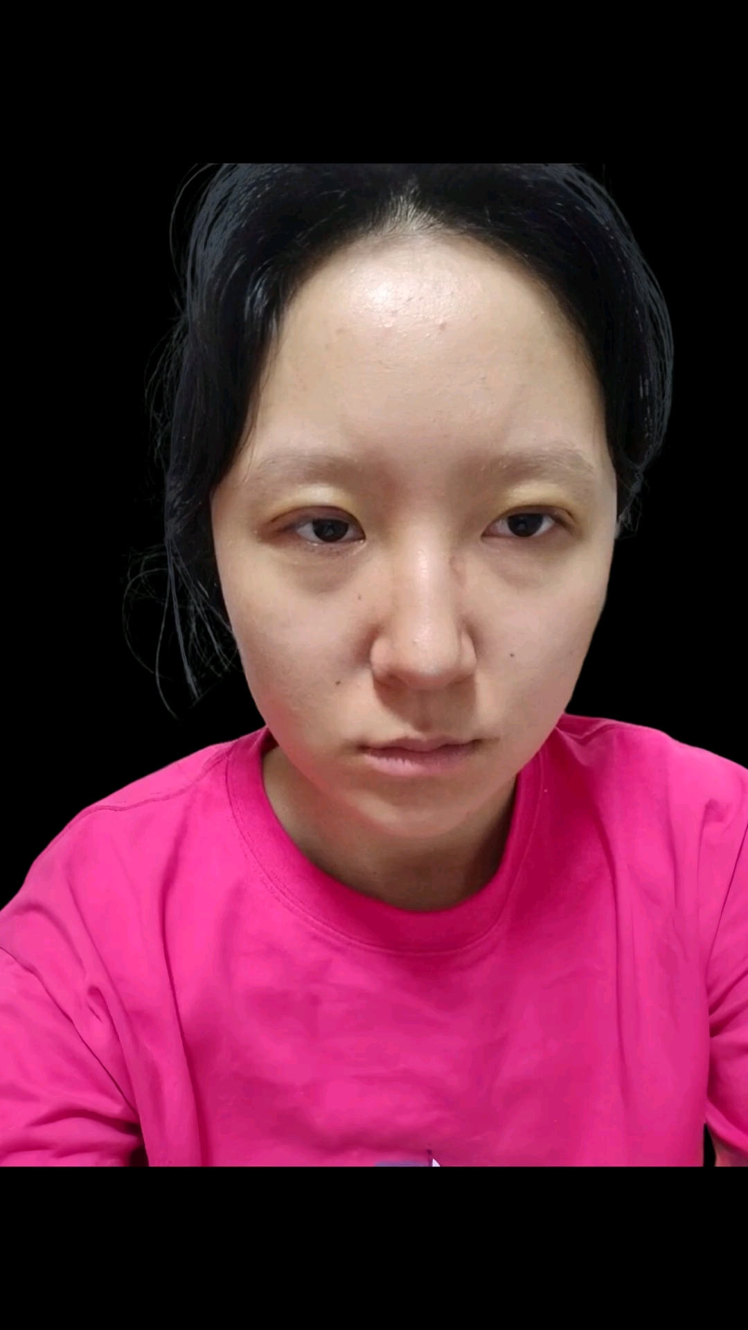 眼睛无神,毁终生!