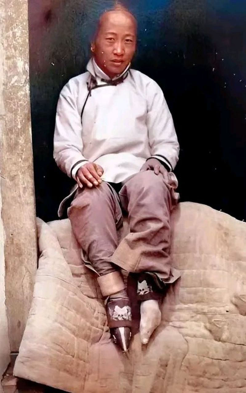 这样的小脚对女人是一种摧残,愚昧无知的思想真可怕!