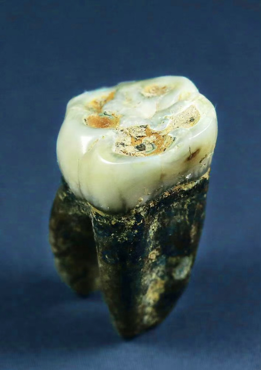 隋炀帝的牙齿.  67[笑哭][笑哭][笑哭]