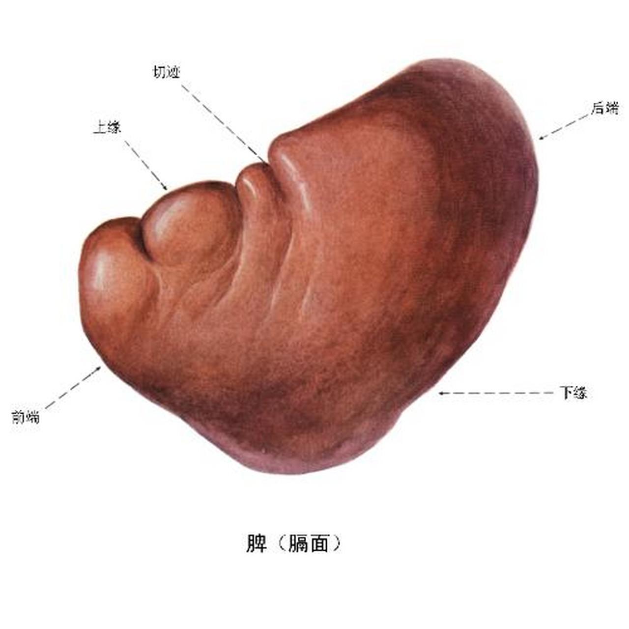 脾凝固性坏死手绘图图片