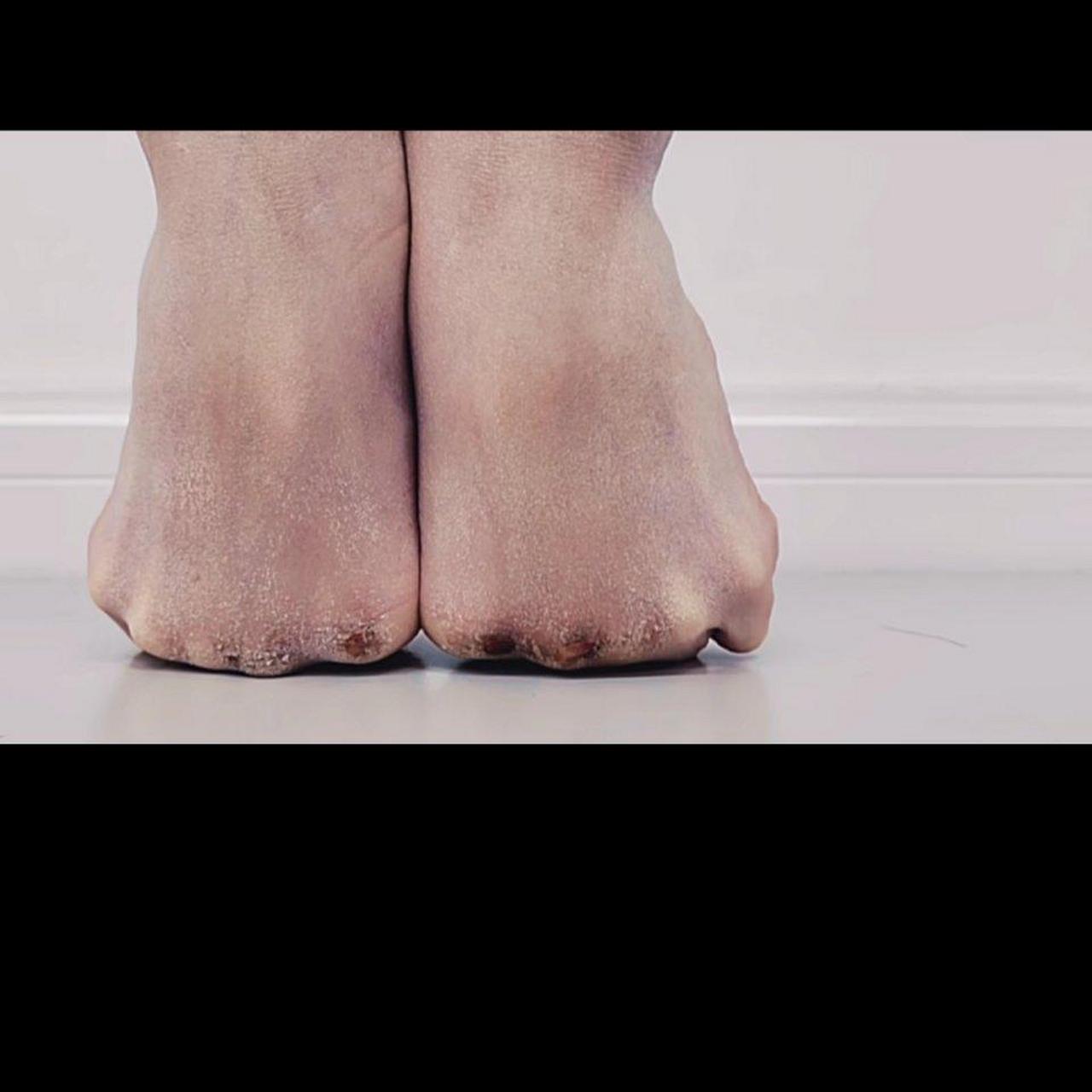 芭蕾舞者的脚,看着都疼