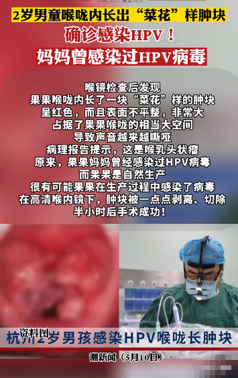 男童喉咙长菜花样肿块确诊感染hpv "性传播才是高危 "  人本身就携带