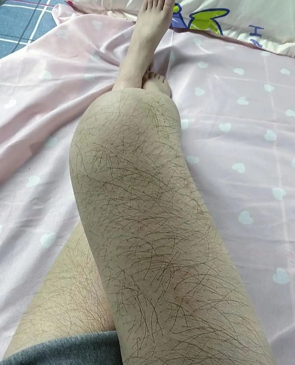 女生长腿毛真的不好看,有什么办法可以去除吗?