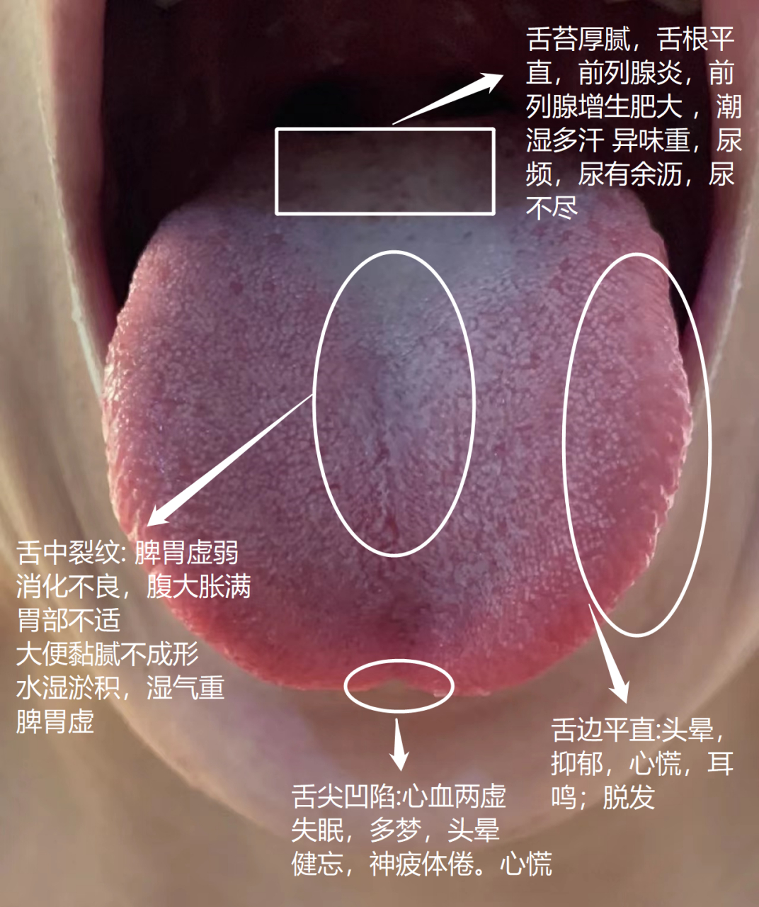 粉丝问诊舌像#失眠# #中医