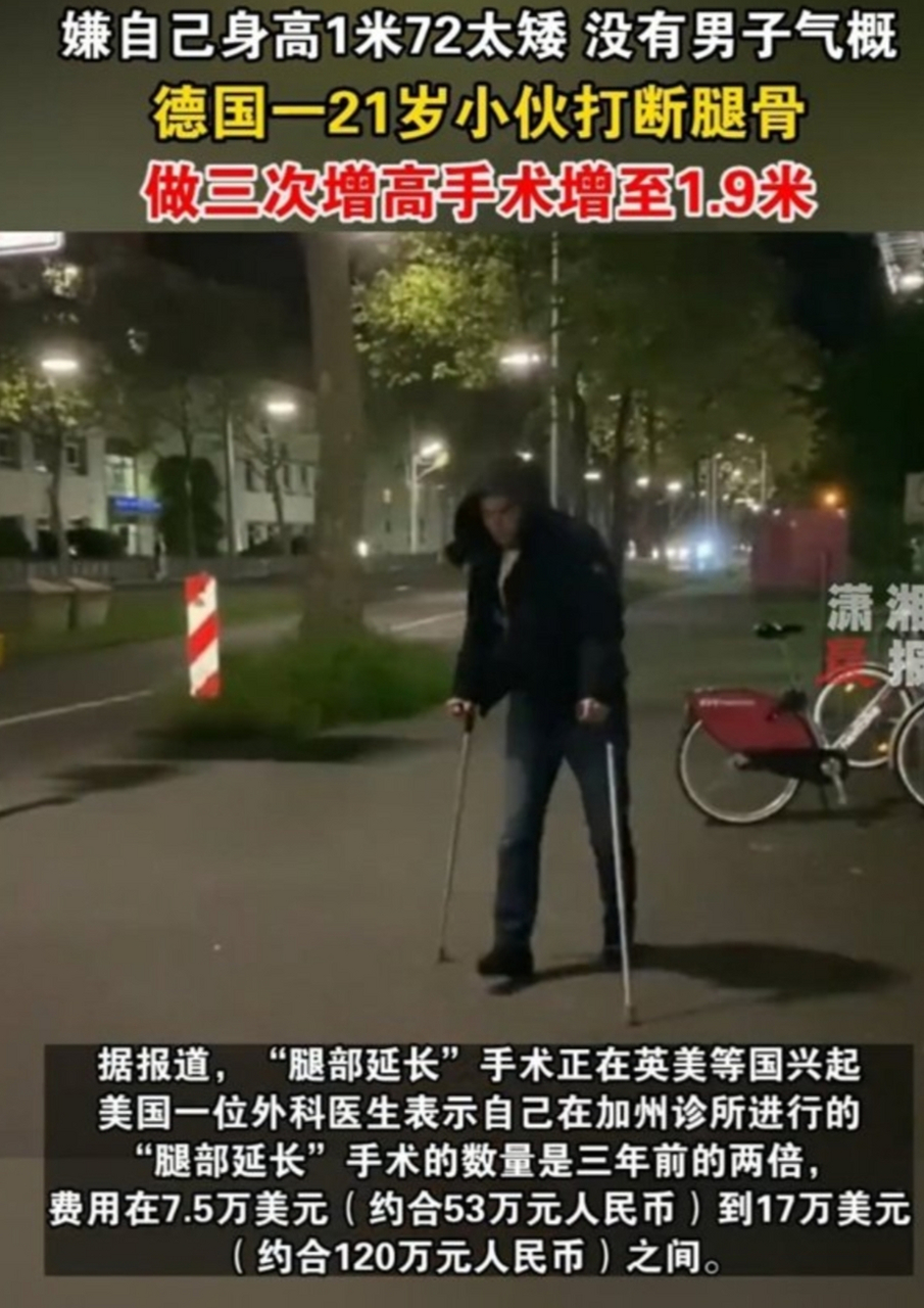 德国男子连做三次断骨增高长至1米9 据外媒报道,德国一名男子因为嫌弃