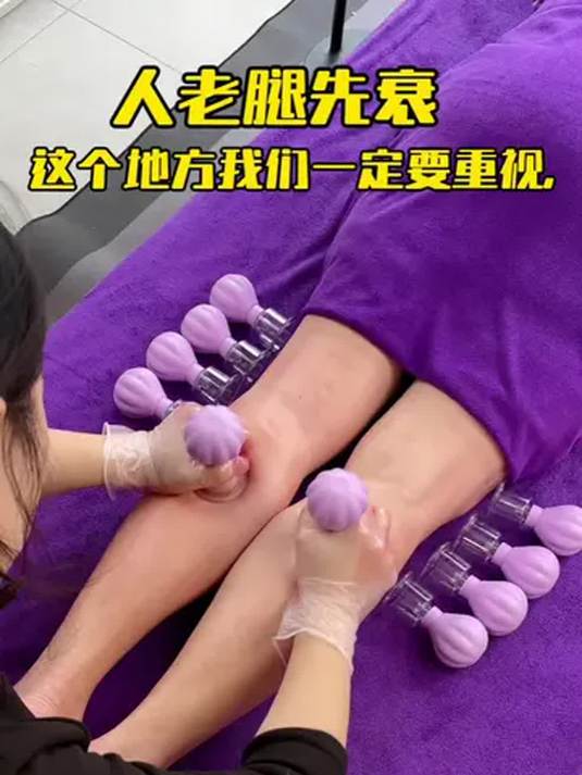 拔罐养生来帮您!效果超棒
