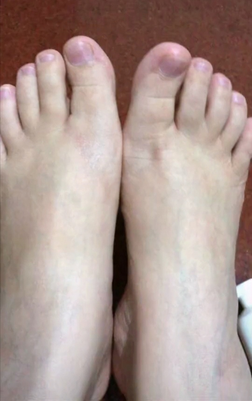 表妹的脚丫目测35码#美腿玉足# #灵活的小脚丫# #无处安放的小jio
