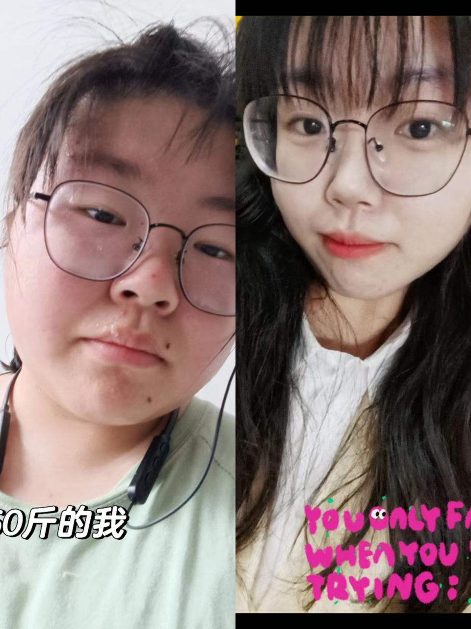 甲减前后对比图,甲减好了人都小了一圈!#甲减