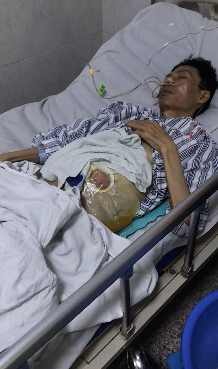 我爸癌症晚期,看着很难受[流泪]肚子涨的跟球一样,怎么办怎么办