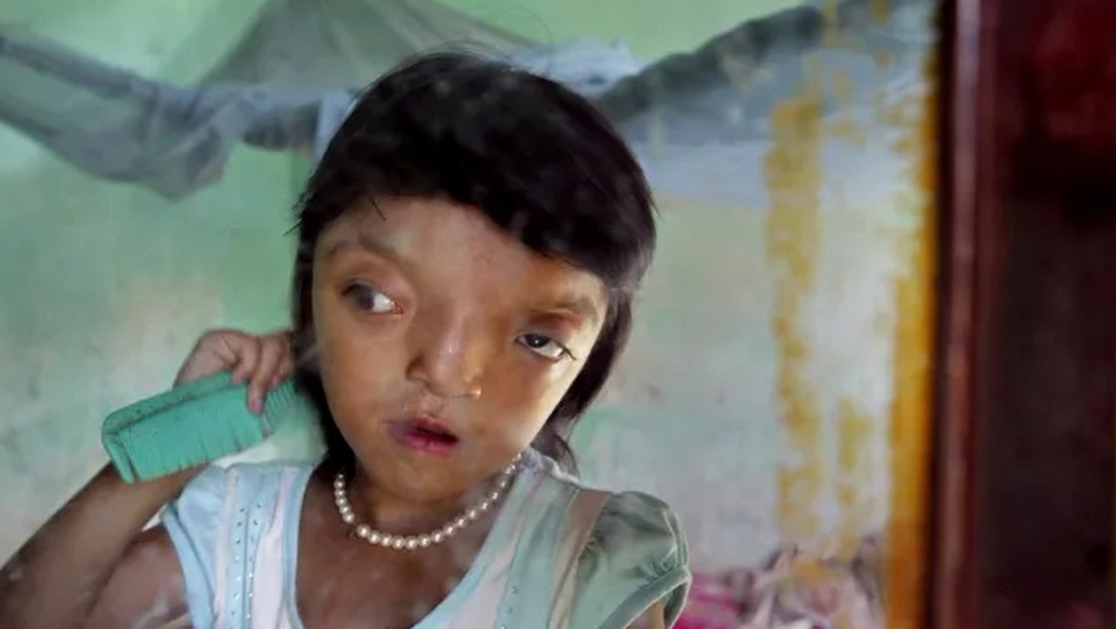 这些都是受到"橙剂"影响的畸形越南儿童,据统计,210万到480万不等的越