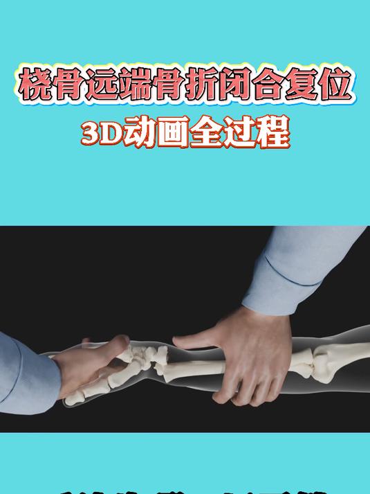 中医正骨领域新突破：柳位正骨引领健康潮流