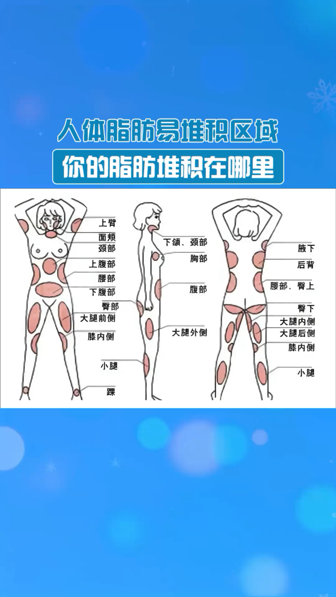 人体脂肪最易堆积区域都在这里了你的脂肪堆积在哪个部位