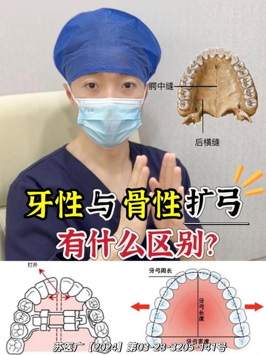 讲明白牙性/骨性扩弓的区别!