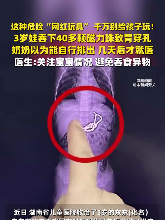 吃了磁力珠多长时间有反应_吃磁力珠子症状是什么 吃了磁力珠多长时间有反应_吃磁力珠子症状是什么（如果吃了磁力珠几天有反应） 磁力资讯