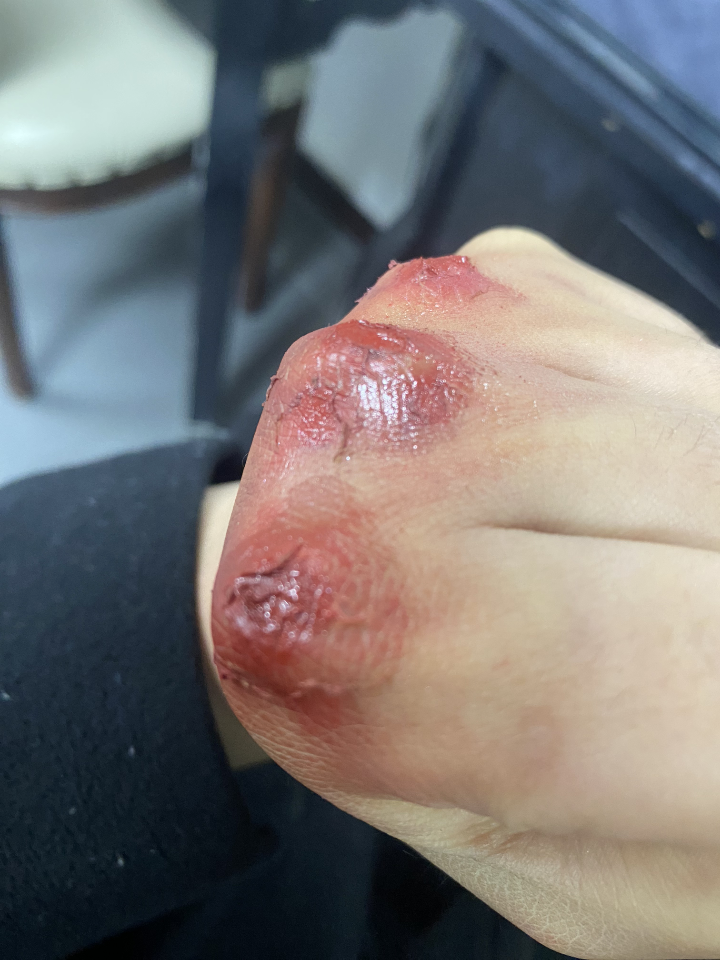 分享一款伤口妆特效妆