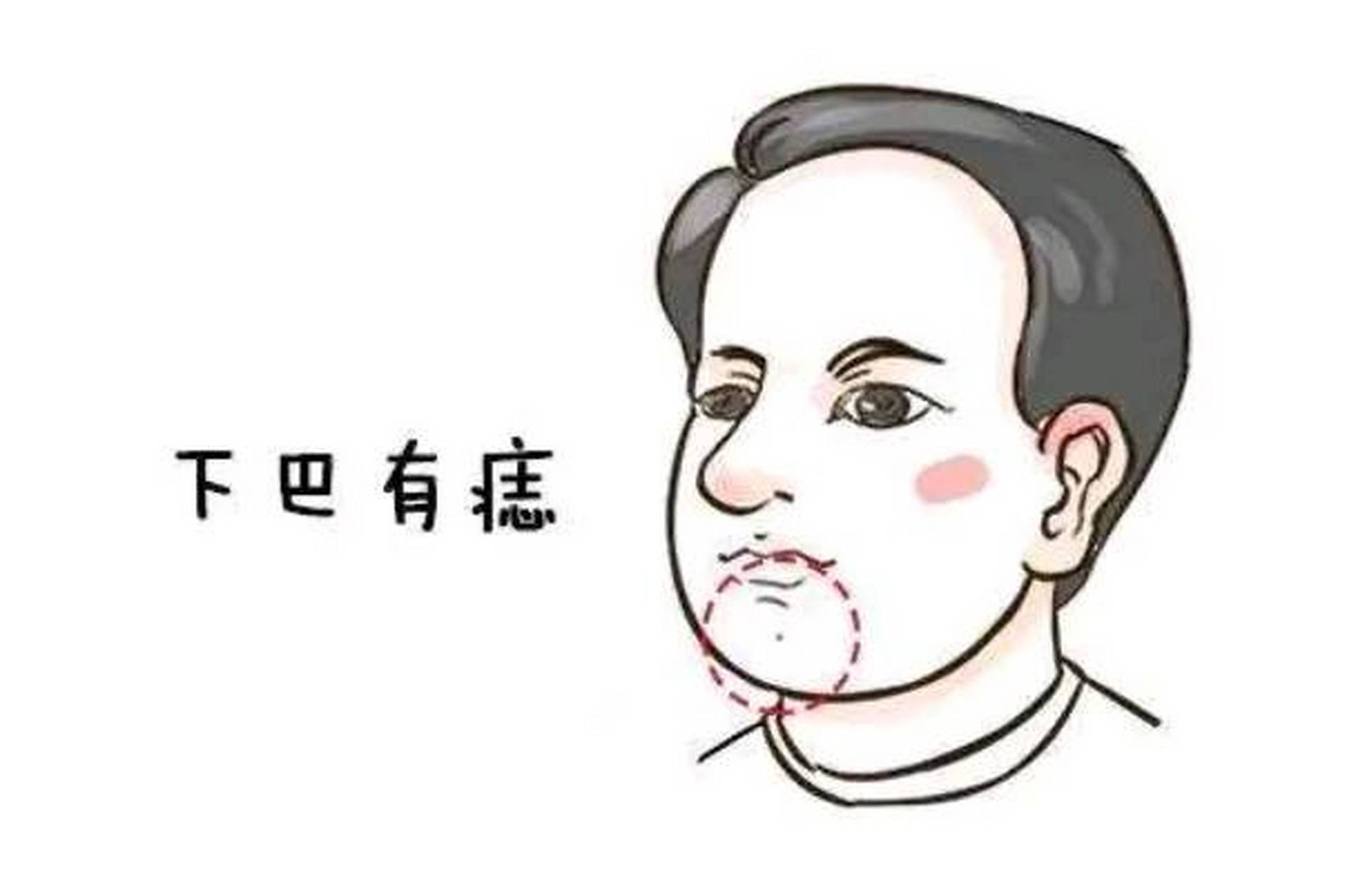 下巴有痣 在相学命理中,下巴位置长有痣,代表着财富,能有好事业,财运