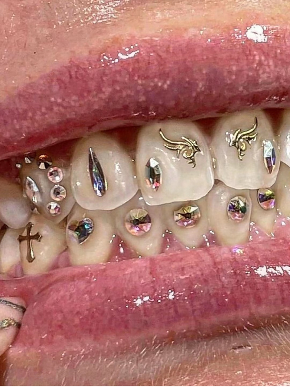 牙齿贴钻,第一次见[尬笑]