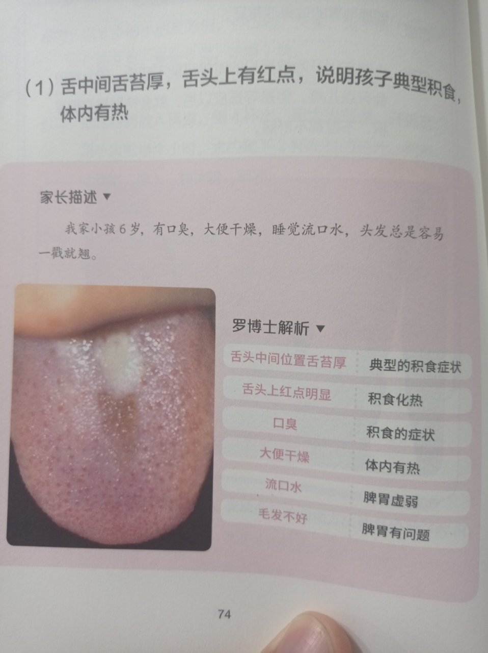 为什么舌苔厚