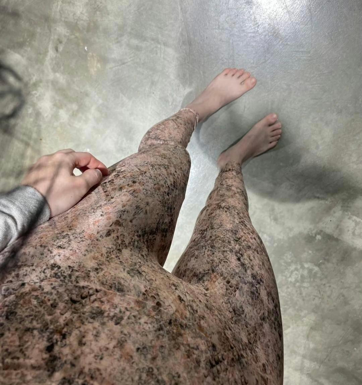 我还以为腿毛过于茂密