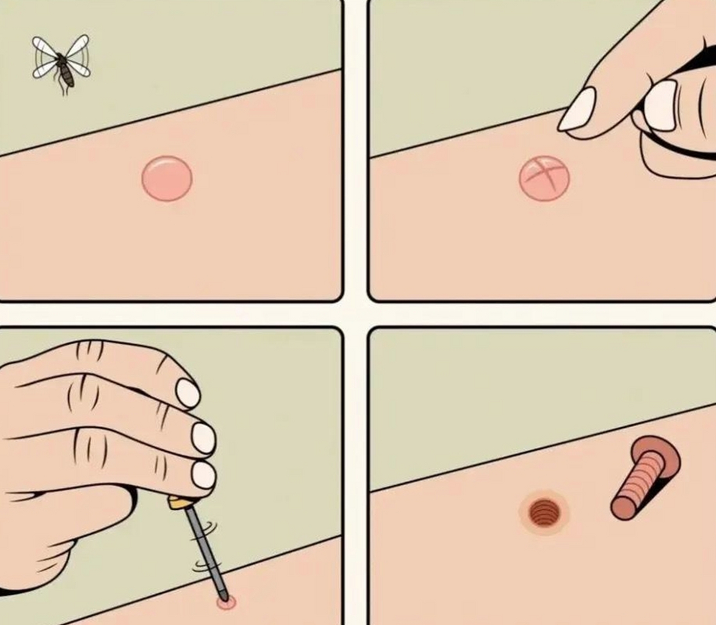 蚊子咬了不用怕,我有一招"十字封印术",可以让痒痒无处遁形.