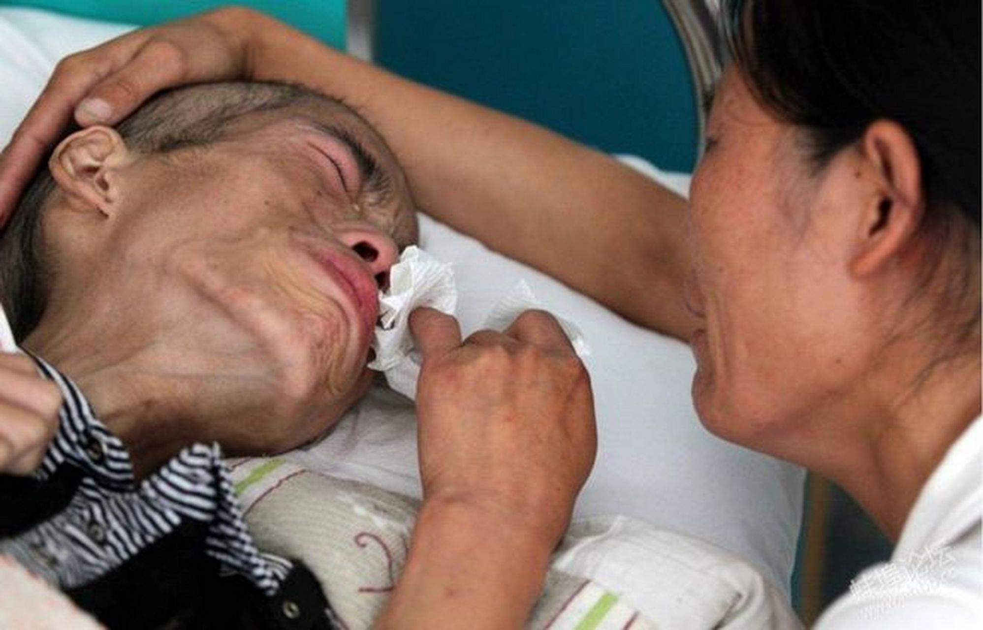 人得了癌症,会怎么样呢?