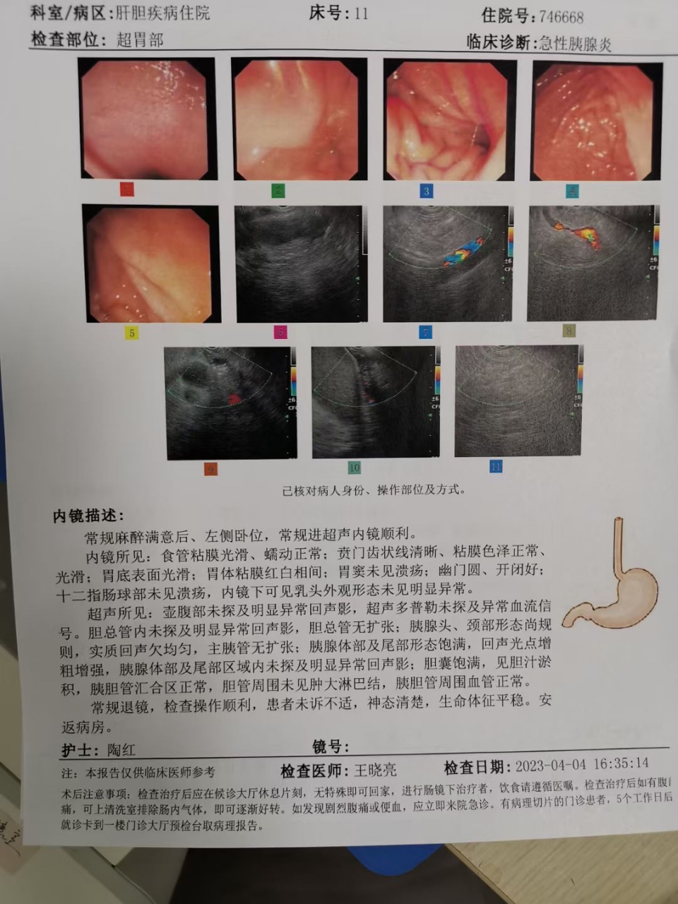 富士超声内镜图片