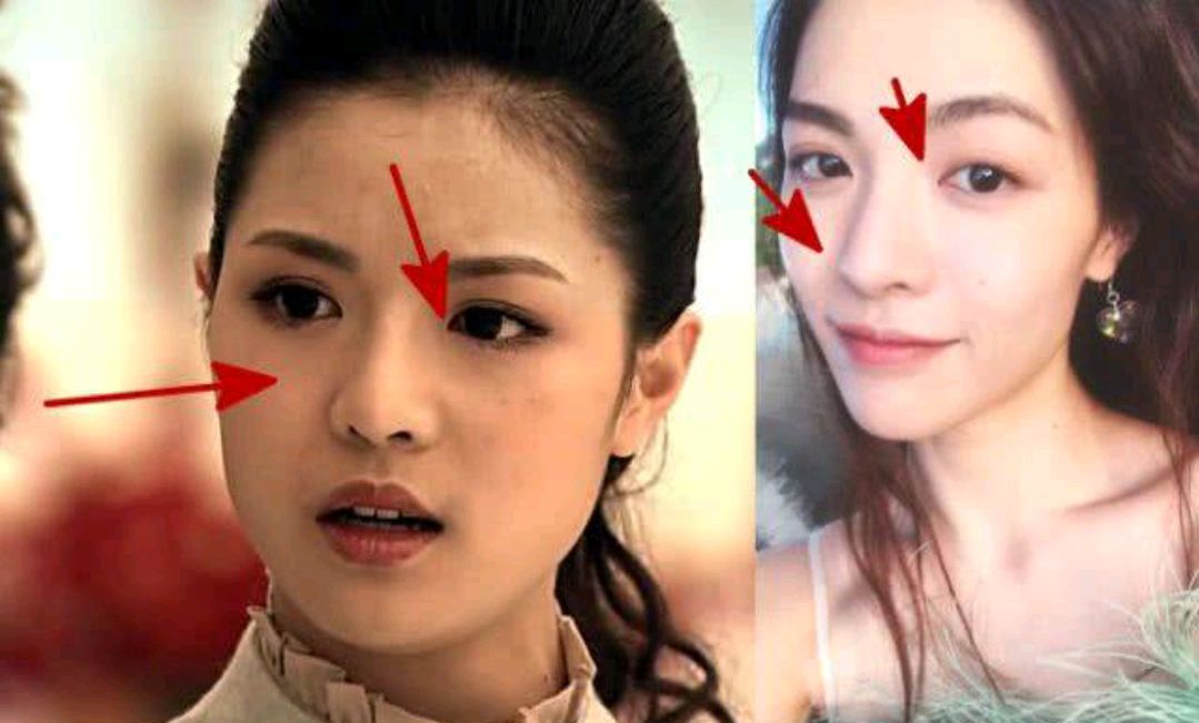 钟楚曦不认整容吗