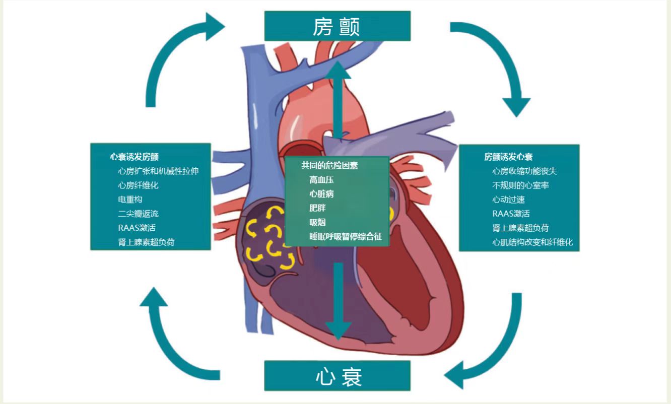 医生:心力衰竭分为急性和慢性,慢性心力衰竭前期有许多诱因,患上这种