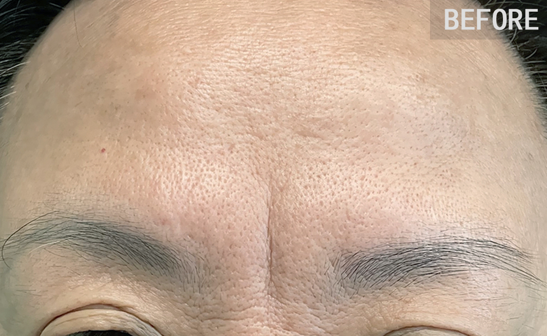 古人云"悬针破印,刑夫克子",有悬针纹的人内心世界什么样?