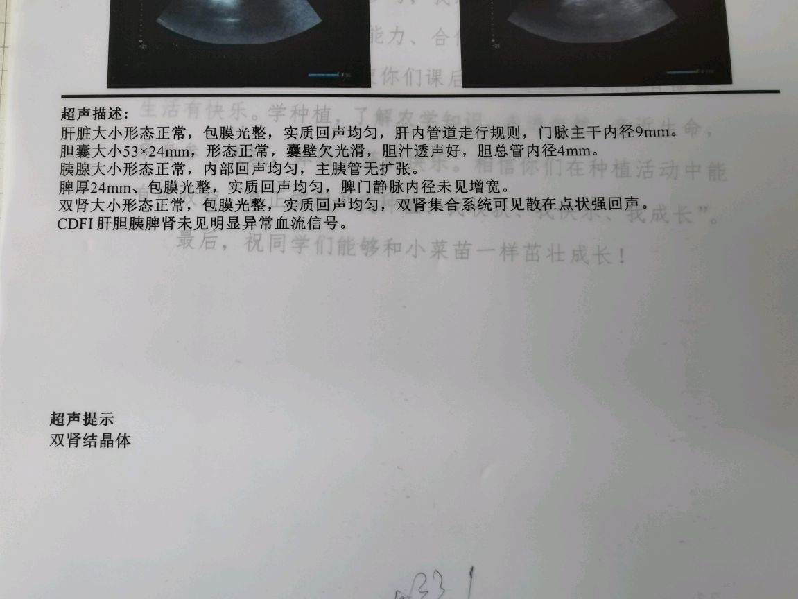 双肾结晶什么鬼?