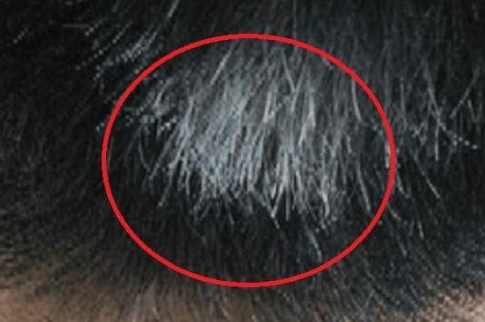 白发长在哪,病就从哪出?长在前额,两鬓,后脑勺,分别代表什么