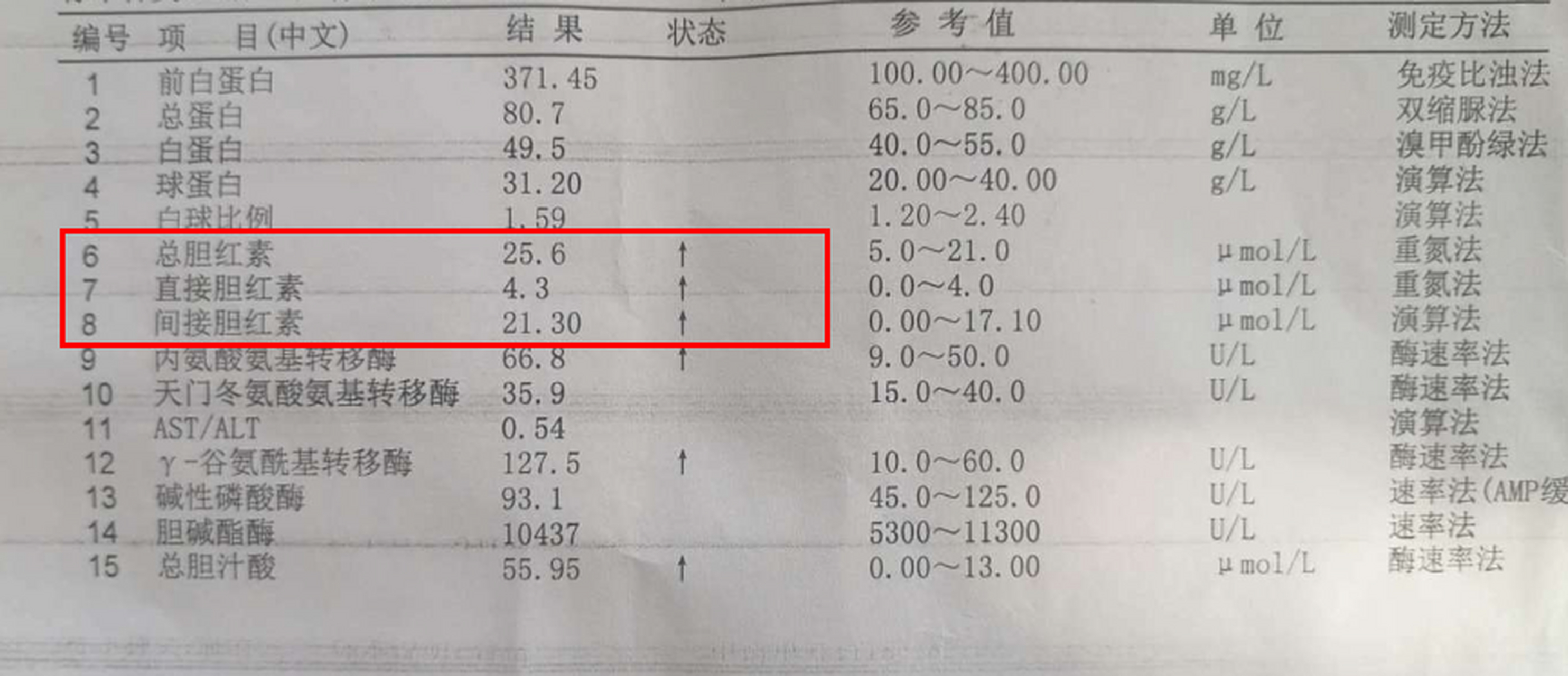 这是因为胆汁流通受阻,导致体内堆积的胆红素无法顺利排出.