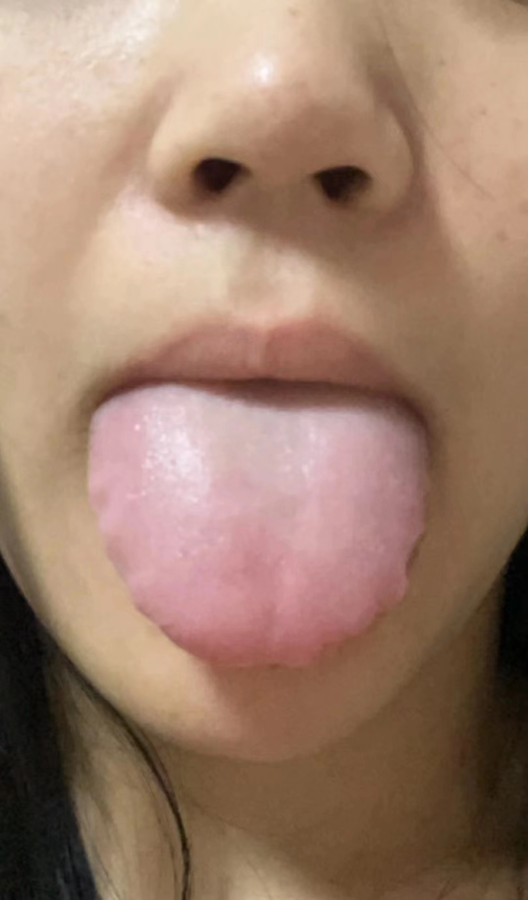 咽喉有异物感舌体胖大有齿痕,舌苔白微厚,舌质淡