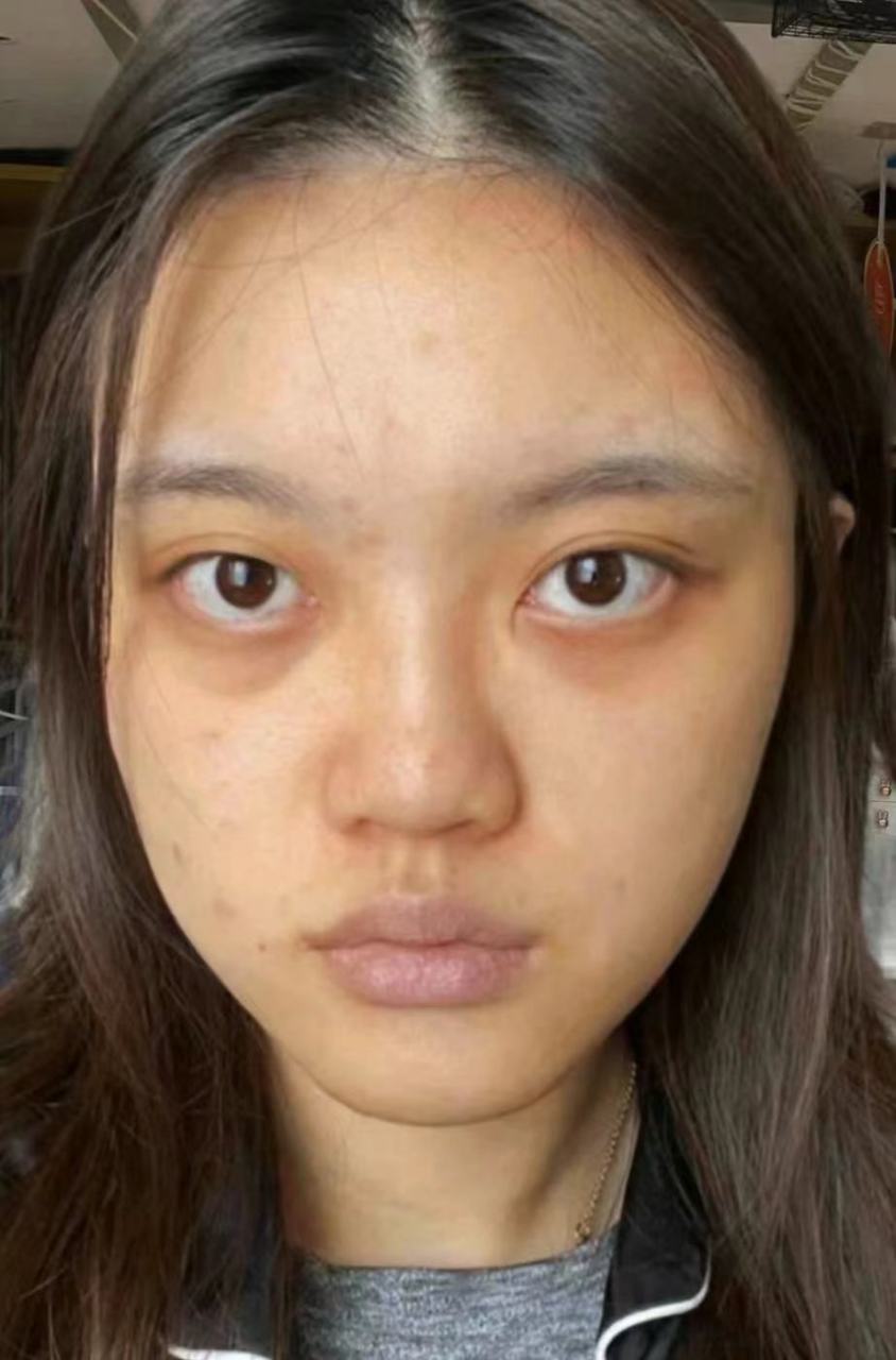 然而,通过恰当的护理和一些改变生活习惯的方法,可以有效改善肤色暗黄