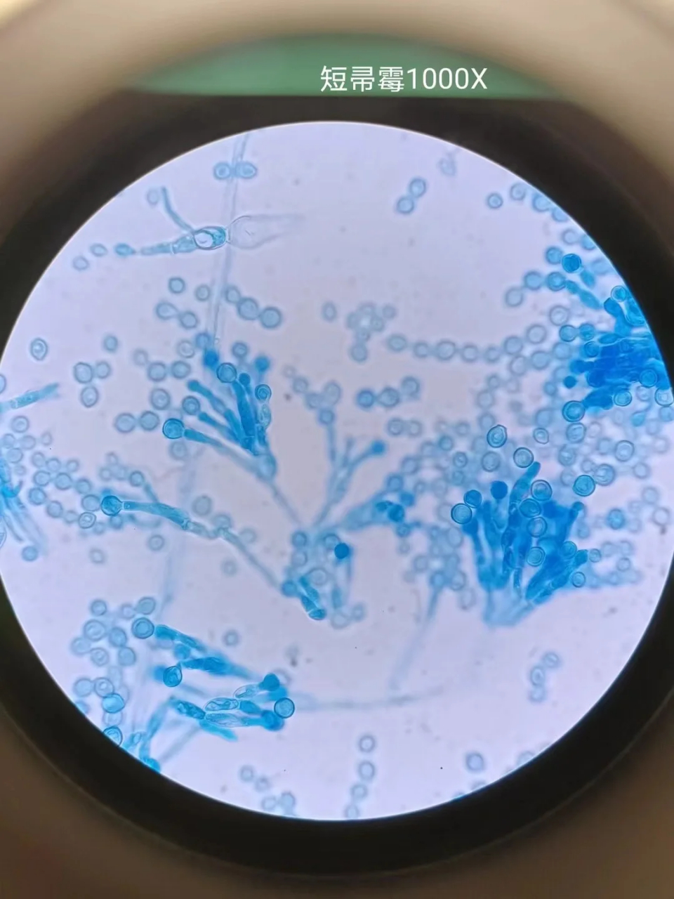 分享在进修期间看到的各种真菌形态