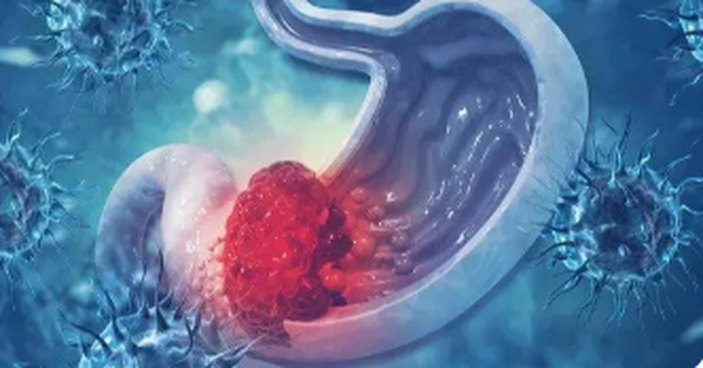 你知道么?胃癌几乎都是吃出来的!烧烤,油炸类食物,香烟,酒……这些美