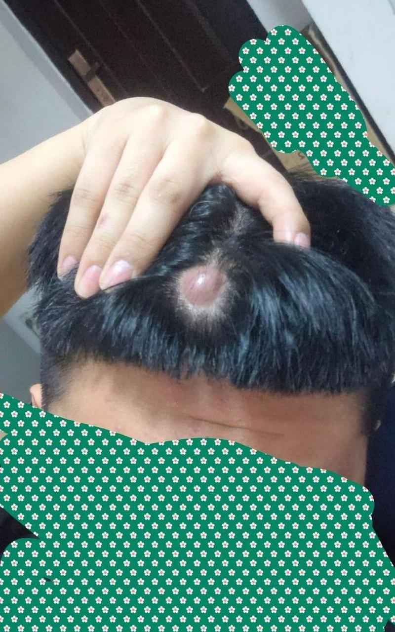 原来头上长摄像头是这么样的哇!